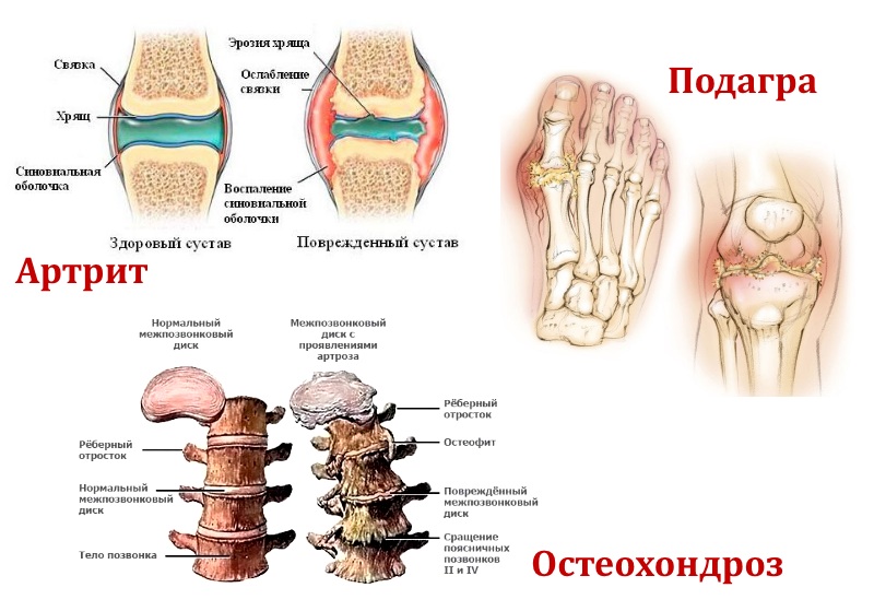 Целебные свойства овса при лечении суставов
